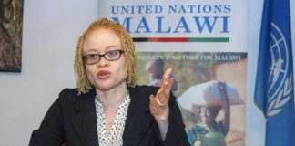 Malawi: les albinos menacés de "disparition" à cause de la sorcellerie.
